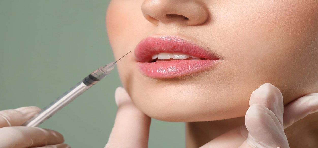 La verdad detrás del relleno de labios