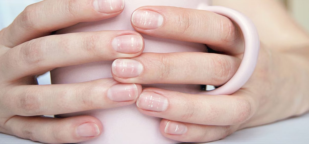 ¿Por qué aparecen las manchas blancas en las uñas?