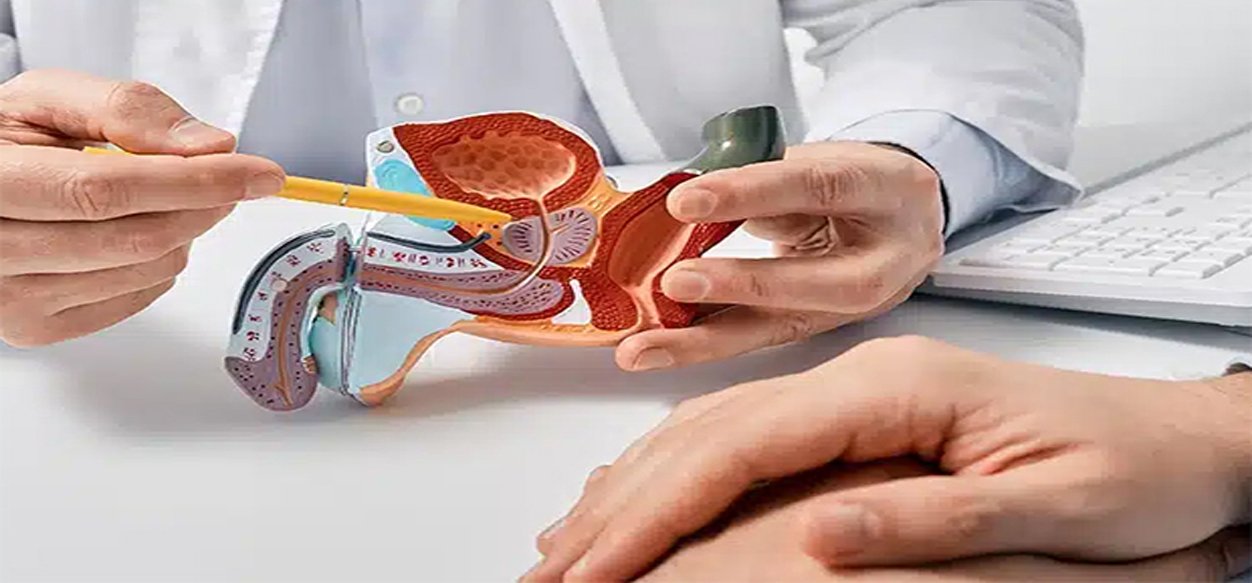 10 hábitos saludables para proteger tu próstata